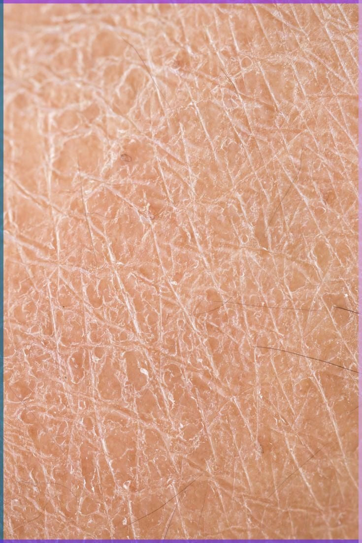 BioSkin Hydro Boost - Kit Piel Seca